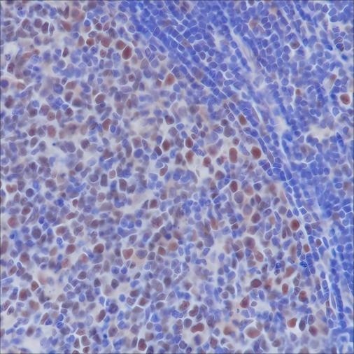 Recombinant MSH2 Monoclonal Antibody - small - 3