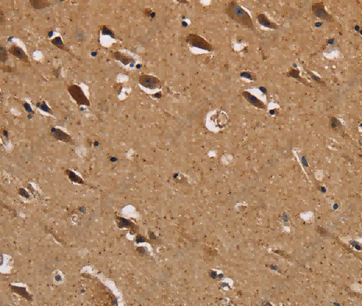 NDUFS1 Polyclonal Antibody - 3