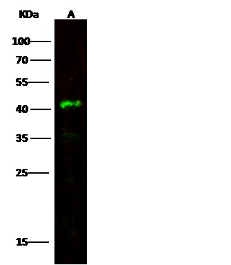 Recombinant LRPAP1 Monoclonal Antibody - small - 4