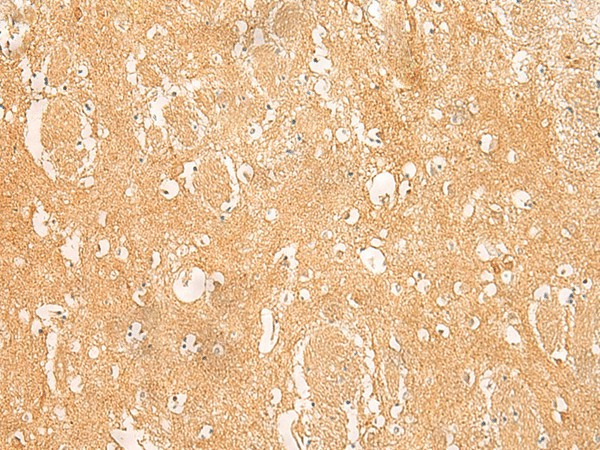 Immunohistochemistry of paraffin-embedded Human brain tissue  using ARPC5L Polyclonal Antibody at dilution of 1:45(?200)