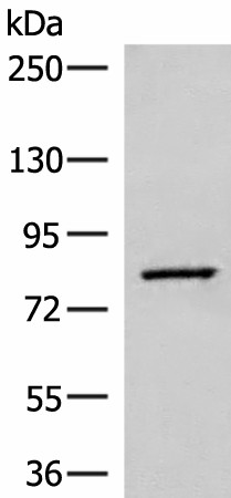 Western blot analysis of Human hepatocellular carcinoma tissue lysate  using SLC26A3 Polyclonal Antibody at dilution of 1:250