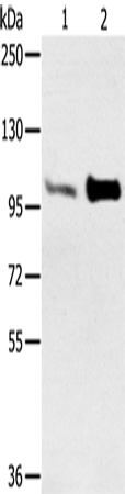 Western Blot analysis of Mouse muscle and heart tissue using ACTN2 Polyclonal Antibody at dilution of 1:300