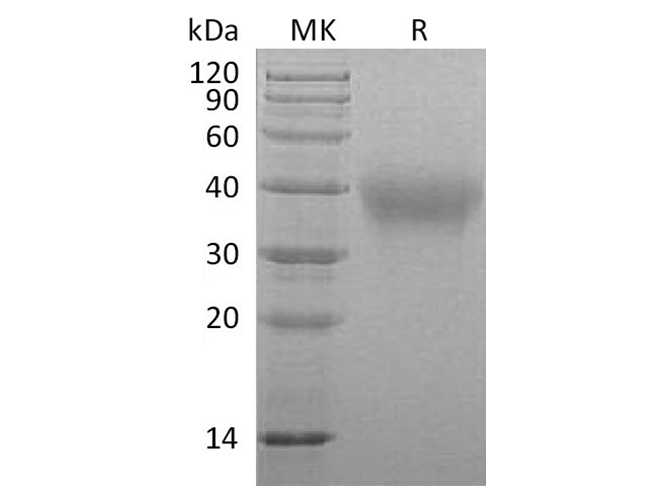 Recombinant Marmoset TIM-3/HAVCR2 Protein (His Tag)