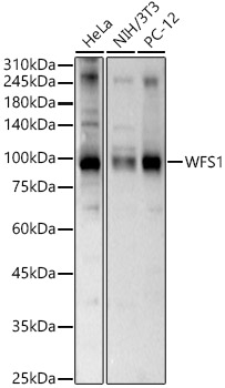 Western blot analysis of various lysates using WFS1 Polyclonal Antibody at 1:1000 dilution.