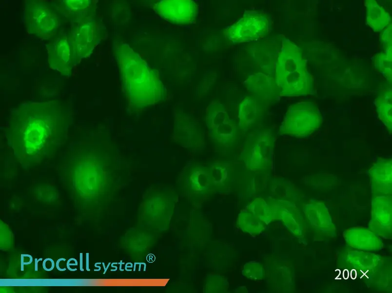 A549-GFP - 5