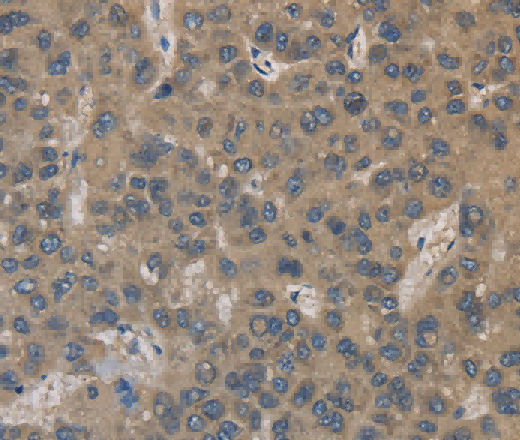 EMC8 Polyclonal Antibody - 2