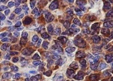 Recombinant CDK1/Cdc2 Monoclonal Antibody-searchlist-3