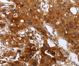 PLAUR Polyclonal Antibody - 2