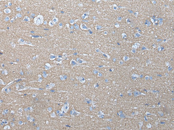 Immunohistochemistry of paraffin-embedded Human brain tissue  using ETFB Polyclonal Antibody at dilution of 1:40(?200)