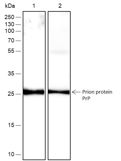 Recombinant Prion protein PrP Monoclonal Antibody-searchlist-1