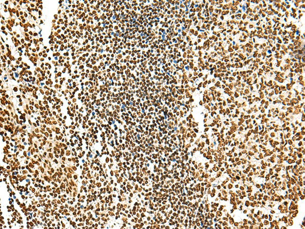 Immunohistochemistry of paraffin-embedded Human tonsil tissue  using HABP4 Polyclonal Antibody at dilution of 1:55(?200)