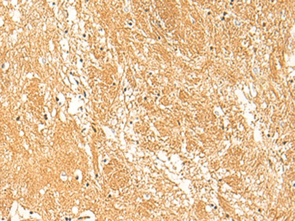 Immunohistochemistry of paraffin-embedded Human brain tissue  using STK32C Polyclonal Antibody at dilution of 1:30(?200)