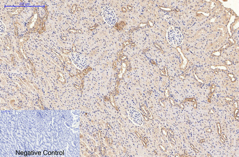 Immunohistochemistry of paraffin-embedded Rat kidney tissue using CD21 Monoclonal Antibody at dilution of 1:200.