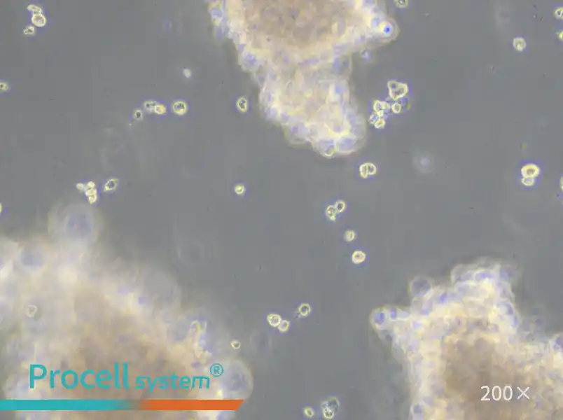 AtT-20 Cell Complete Medium - small - 6