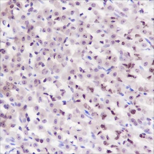 Recombinant MCM5 Monoclonal Antibody - 3