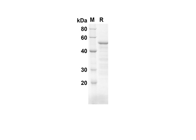 Recombinant Human CD200 Protein( Fc Tag)-产品推荐-1