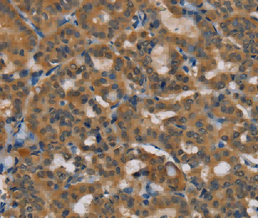 TAB3 Polyclonal Antibody - 2