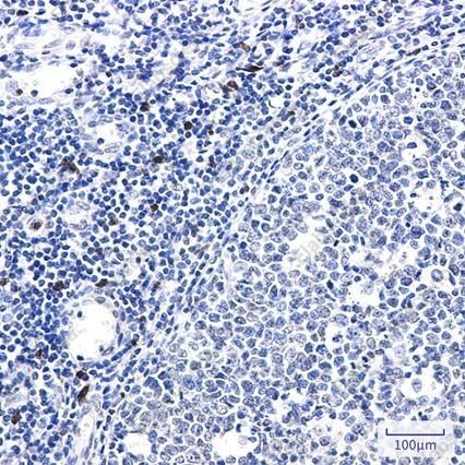 Recombinant IL-26 Monoclonal Antibody - 2