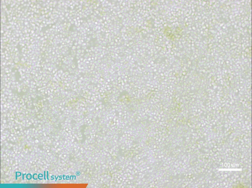 OKT 11 Cell Complete Medium - 1