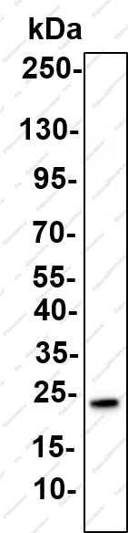 Recombinant SOCS 2 Monoclonal Antibody - 2