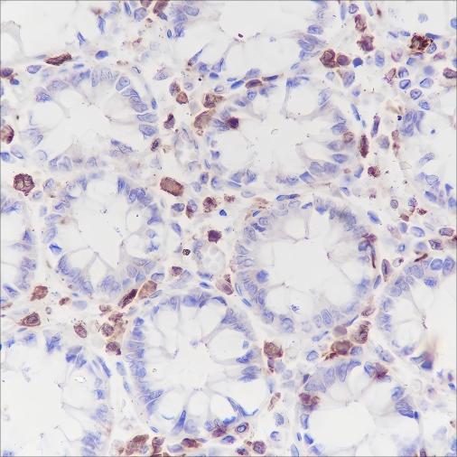 Recombinant CSF-1R Monoclonal Antibody-searchlist-1