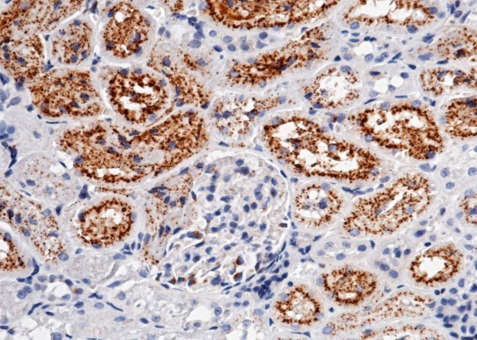 Recombinant Cystatin C/CST3 Monoclonal Antibody-searchlist-1