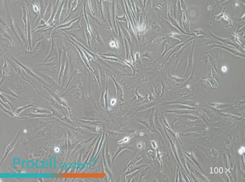 FTC-133 Cell Complete Medium - 3