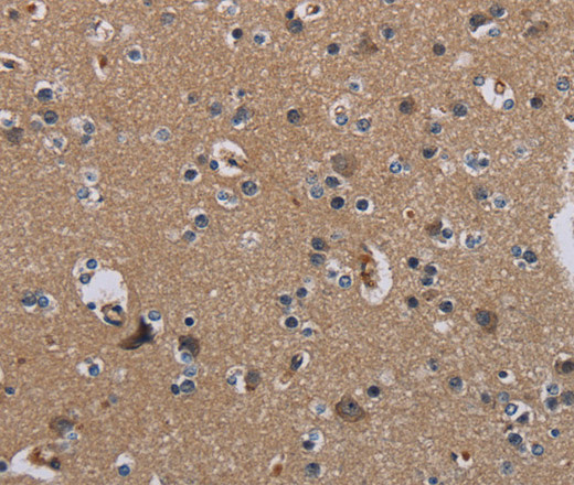 Immunohistochemistry of paraffin-embedded Human brain  tissue using PIDD1 Polyclonal Antibody at dilution 1:50