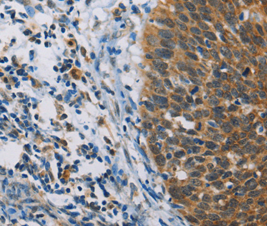 Immunohistochemistry of paraffin-embedded Human tonsil  using FXYD1 Polyclonal Antibody at dilution of 1:60