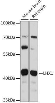 Western blot analysis of extracts of various cell lines using LHX1 Polyclonal Antibody at 1:1000 dilution.