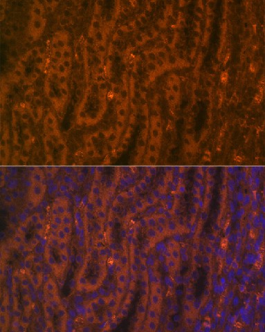 Immunofluorescence analysis of rat kidney using ACE2 Polyclonal Antibody at dilution of 1:100 (40x lens). Blue: DAPI for nuclear staining.