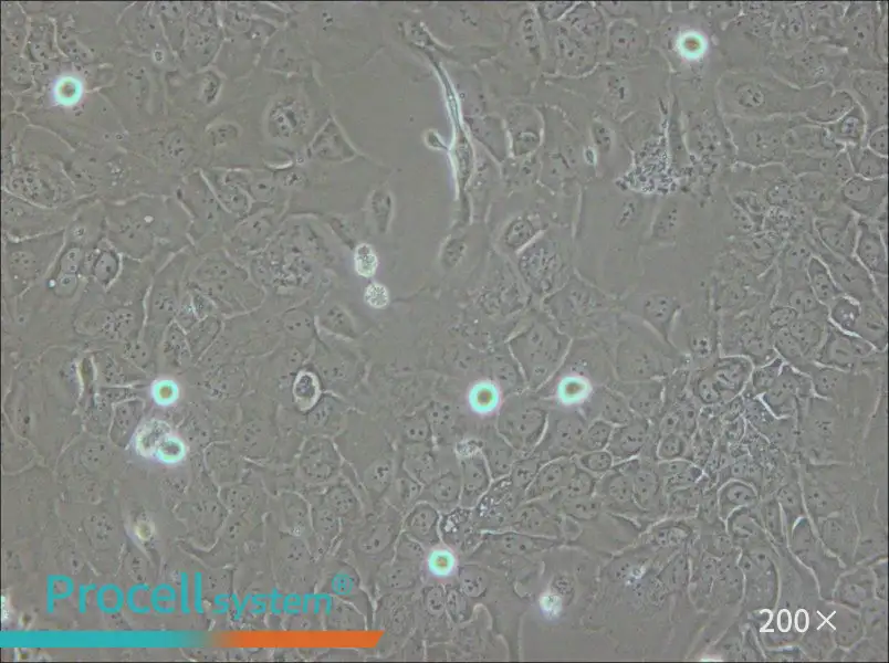 SCC-9 [SCC 9; SCC9] Cell Complete Medium - small - 5