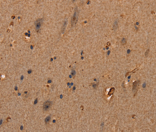 Immunohistochemistry of paraffin-embedded Human brain  tissue using COL18A1 Polyclonal Antibody at dilution 1:40