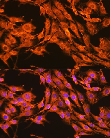 Immunofluorescence analysis of C6 cells using PKM2-specific Polyclonal Antibody at dilution of 1:100 (40x lens). Blue: DAPI for nuclear staining.