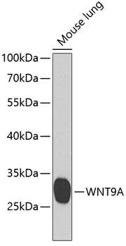 Western blot analysis of extracts of mouse lung using WNT9A Polyclonal Antibody at 1:1000 dilution.