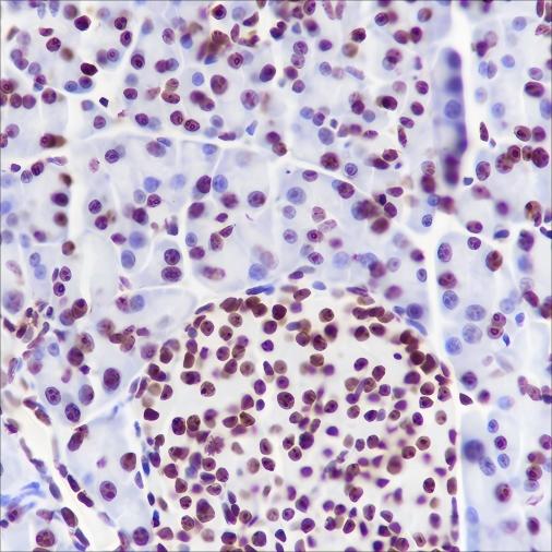 Recombinant NPM1 Monoclonal Antibody - 3