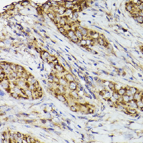 Western blot analysis of Mouse lung using COX2 Polyclonal Antibody at 1:1000 dilution.