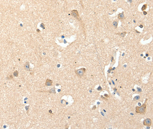 Immunohistochemistry of paraffin-embedded Human brain tissue using RRAD Polyclonal Antibody at dilution 1:50