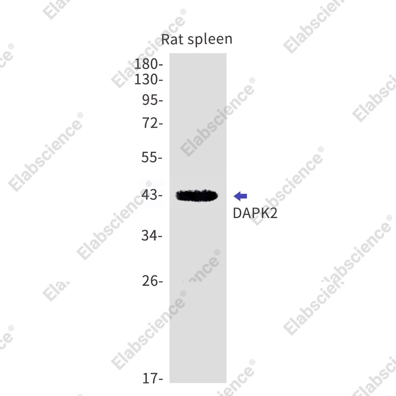 Recombinant DAPK2 Monoclonal Antibody - 1