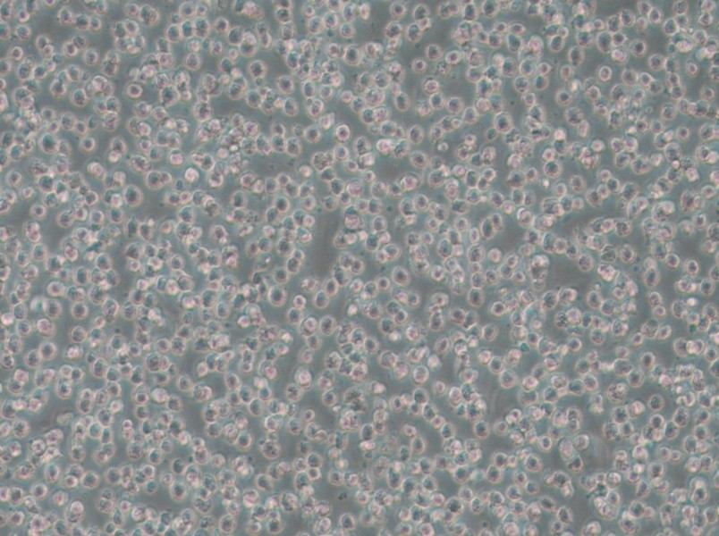 OCI-AML-3 Cell Complete Medium - small - 4