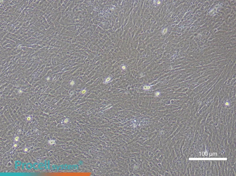 Mouse Mesenteric Smooth Muscle Cell Complete Medium - 2