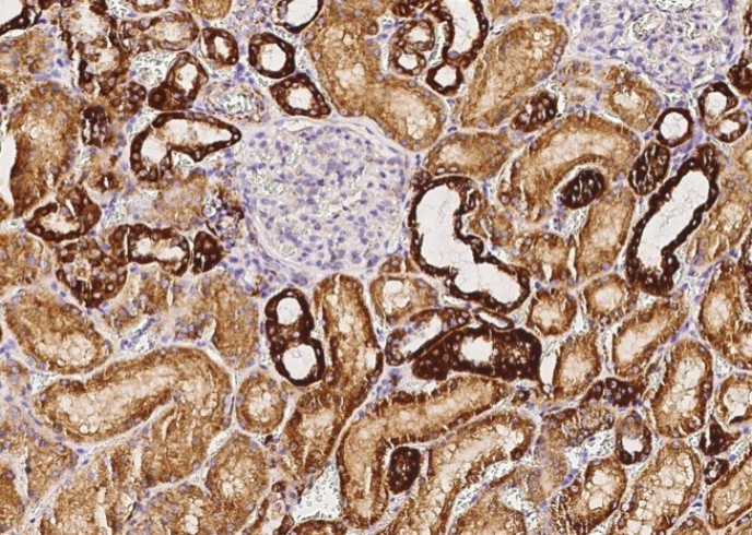 Recombinant COX5B Monoclonal Antibody - small - 2