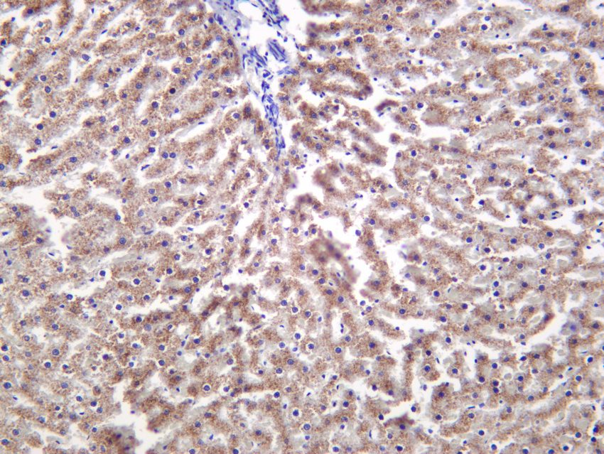 Recombinant ACOX1/AOX Monoclonal Antibody - 3
