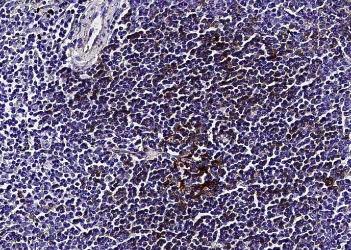 Recombinant CD23/FCER2 Monoclonal Antibody - small - 2