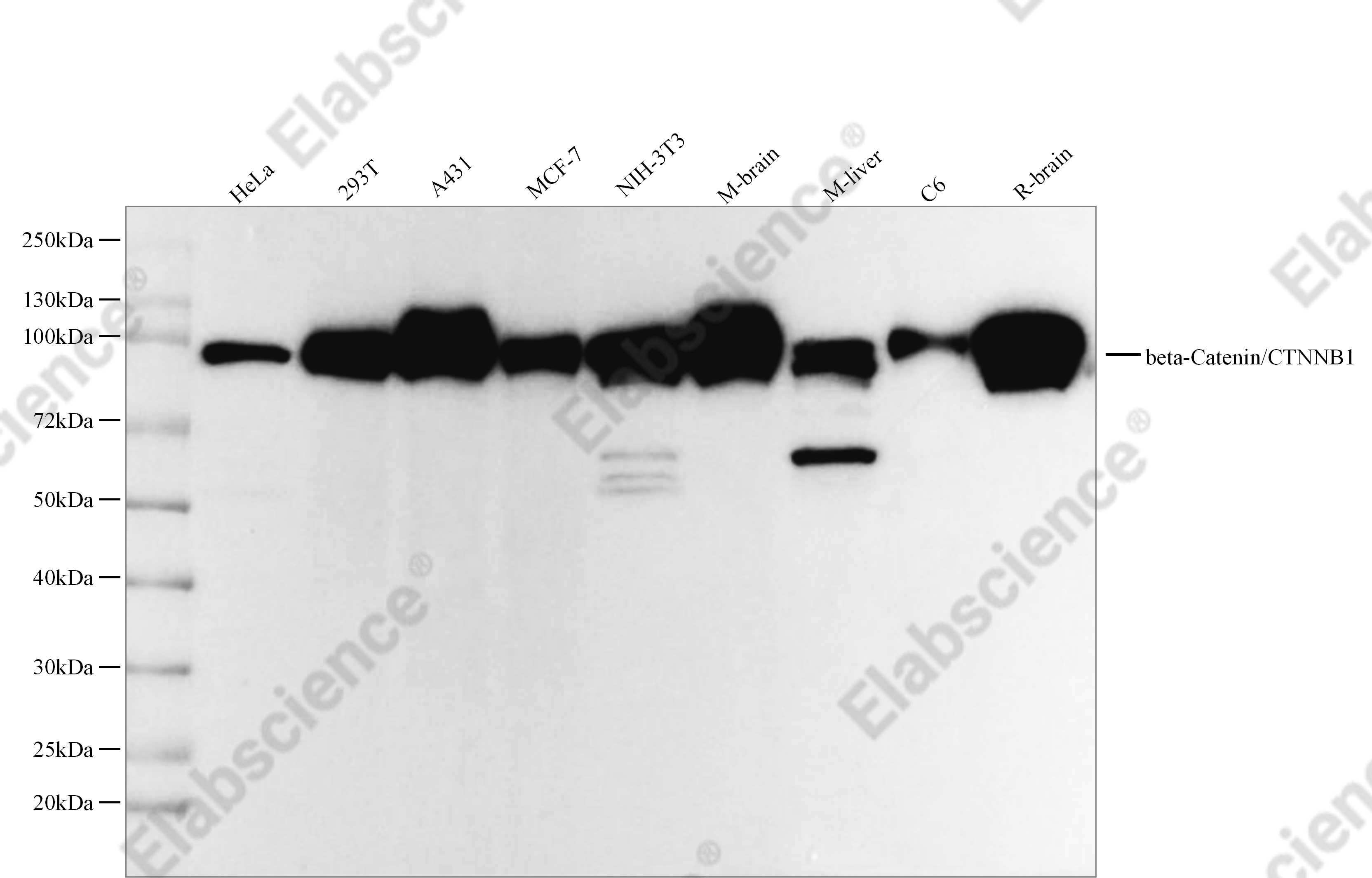 Recombinant beta-Catenin/CTNNB1 Monoclonal Antibody - 1