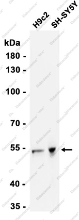 Recombinant CaMKII beta Monoclonal Antibody - 3