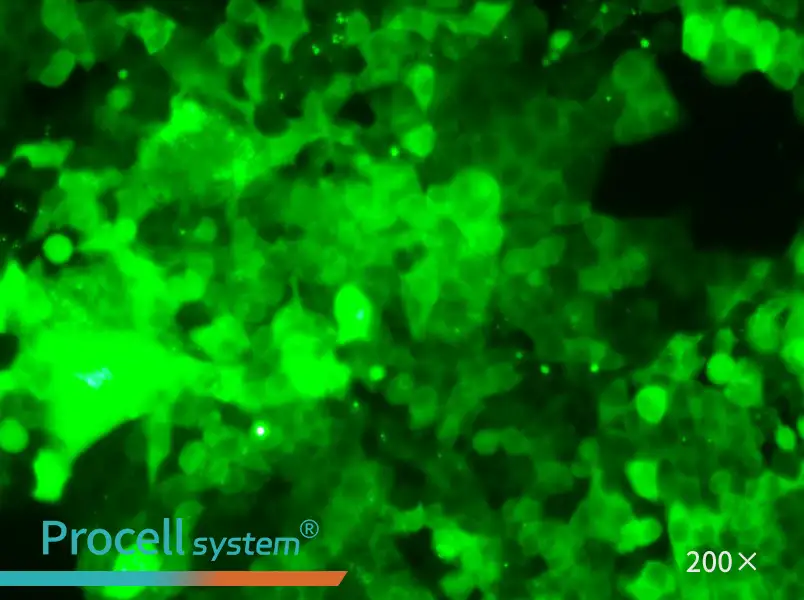 HCT 116-GFP Cell Complete Medium - 5