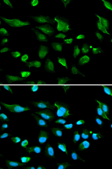 Immunofluorescence analysis of A549 cells using AIRE Polyclonal Antibody