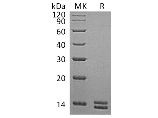 Recombinant Human S100A8&S100A9 Heterodimer Protein (His Tag)