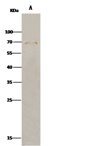 Recombinant FGFRL1/FGFR5 Monoclonal Antibody - small - 2